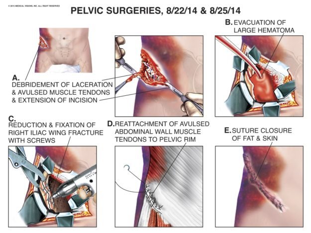 surgery exhibit