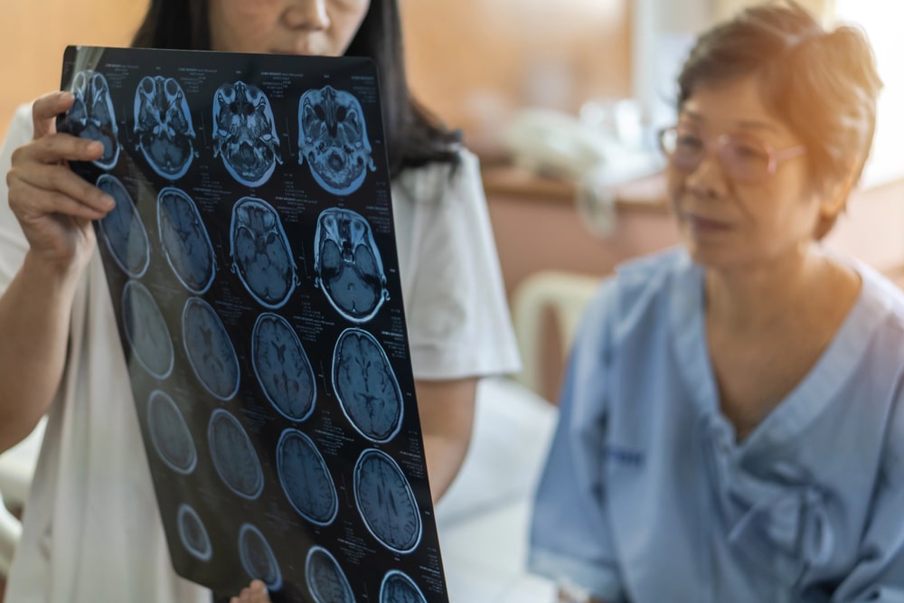 brain injury lawyer Granada Hills, CA
