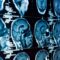 brain injury lawyer Simi Valley, CA
